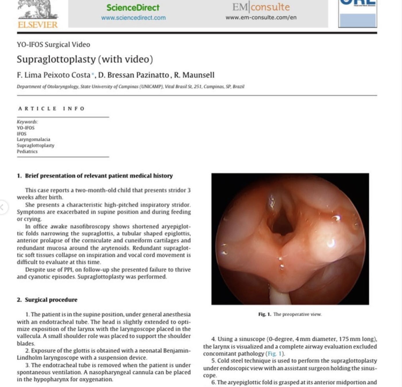 Supraglotoplastia para laringomalácia (European Annals of ORL)